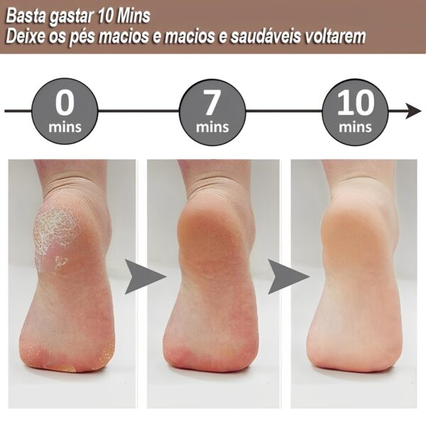 Flawless Pedi Electronic Electronic Pedicure tool – Image 8